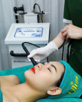 Voucher Detox Thải Độc Da -Thanh Lọc Da Cacbon Co2 - belovedbeyond.com